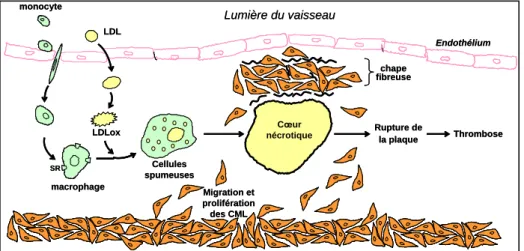Figure 4. Progression de la plaque d’athérosclérose 