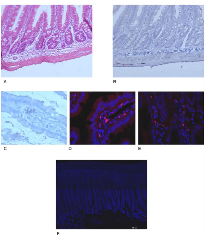 Figure 2B7 : Intestin grêle 