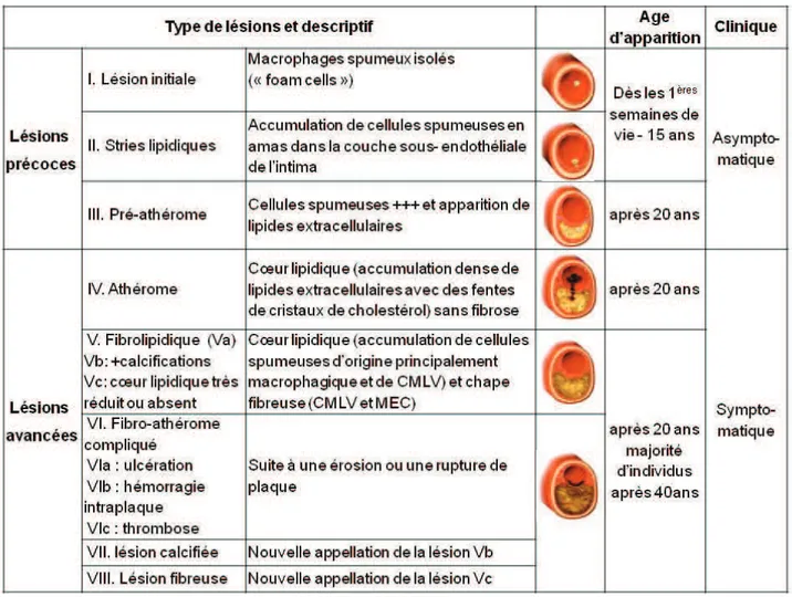 Tableau  I :  Caractéristiques  des  lésions  d’athérosclérose  aux  différents  stades  évolutifs  selon  la  classification  de  l’American  Heart  Association  (Stary,  2000),  illustrées  par  des  coupes transversales d’artère, d’après (Libby, 2002) 