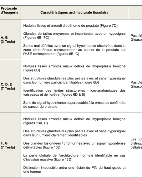 Tableau  4  –  Caractéristiques  comparatives  du  tissu  prostatique  utilisant  différents  protocoles  d'imagerie  avec  l'IRM  3  Tesla  et  7  Tesla  à  haute  résolution  pour 