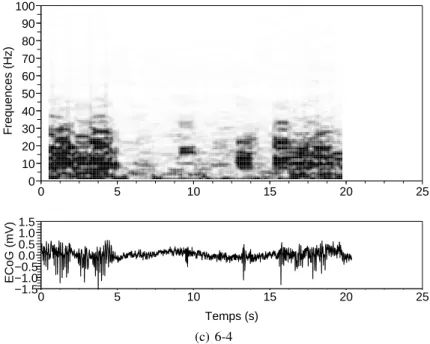 Figure 6 – Spectrogramme de signaux bipôlaires.