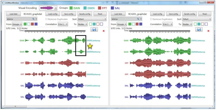 Figure 4: Capture d’écran de la fenêtre principale de LinkWave lors de l’exploration de la connectivité d’un sujet atteint de la maladie de Parkinson (à gauche) et d’un sujet du groupe contrôle (à droite)