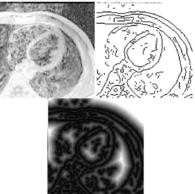 Figure 6: MRI heart image: Original image on the top left, edge image on the top right, distance map on the bottom.