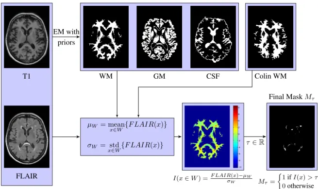 Figure 4. The mask creation uses both FLAIR and T1 modalities to combine intensity-based and tissue-based properties