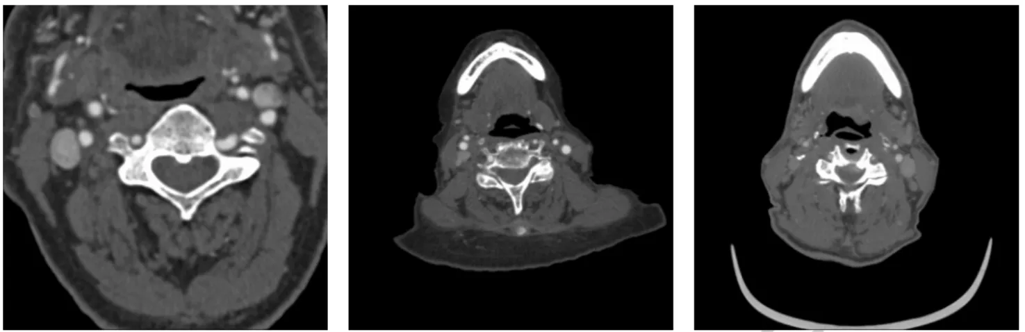Figure 3: Examples of a slice of the CTA datasets. From left to right a slice from Erasmus MC, the Hadassah Hebrew University Medical Centre and Hˆ opital Louis Pradel.