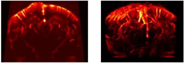 Figure 1: Imagerie Doppler ultrasensible du cerveau de rat. Gauche: acquisition d’un plan coronal du cerveau
