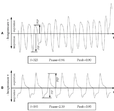 Figure 10 : Barometric plethysmograph : changes in box pressure waveform after metacholine  challenge