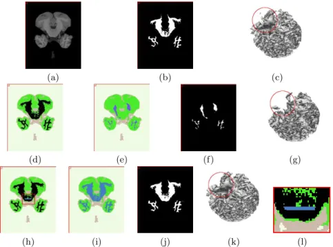 Fig. 6. The simple user interaction can improve the segmentation accuracy dramatically.