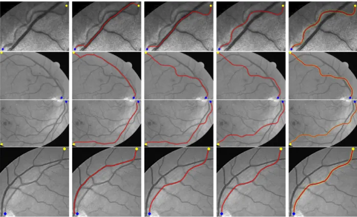 Fig. 9. Comparative results on retinal images. Column 1 Prescribed points which are indicated by dots