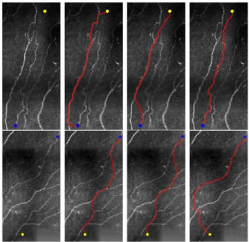 Fig. 11. Comparative results on neural fibre images. Column 1 Prescribed source and end points indicated by blue and yellow dots