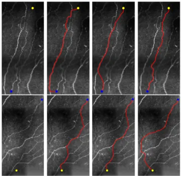 Fig. 11. Comparative results on neural fibre images. Column 1 Prescribed source and end points indicated by blue and yellow dots