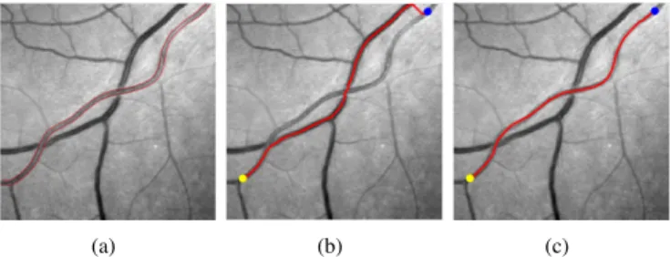 Fig. 1. Short branches combination problem. (a) A retinal image with red curves indicating the true boundaries of the target