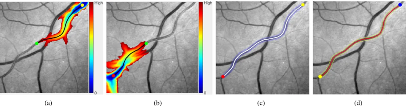 Fig. 7. (a) The geodesic distance map U s superimposed on the retinal patch. The black line indicates the geodesic curve C m,s and the red dot is the point s.