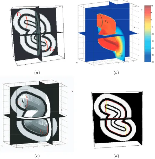 Fig. 10: (a) shows the intersection of a plane with a binary image where three ‘S’ shaped tubes