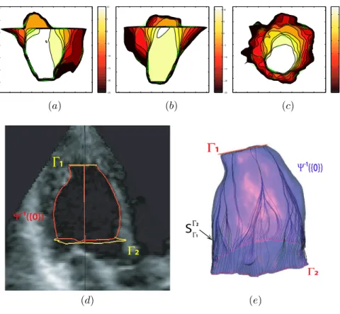 Fig. 11: Left ventricle segmentation : (a),(b) and (c) display some level sets of our solution Ψ