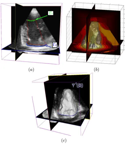 Fig. 12: (a) shows a plane of a 3D ultrasound volume obtained from a patient whose echogenicity