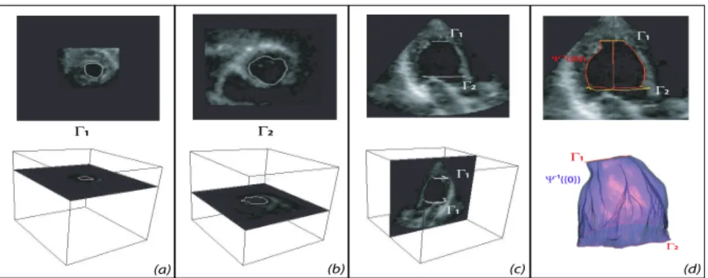 Fig. 1: 3D ultrasound volume of a left ventricle: (a) and (b) show the two parallel slices where