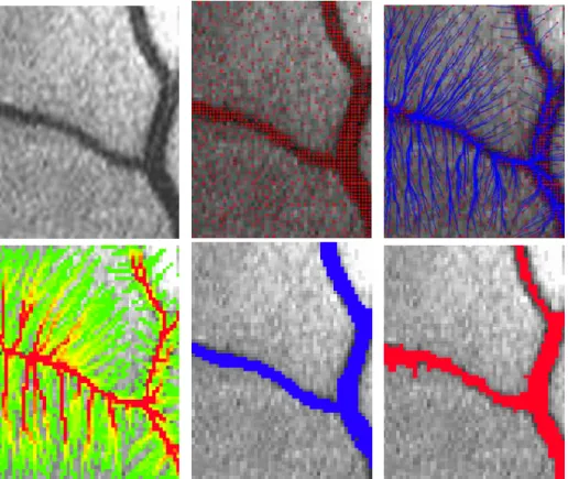 Figure 3: Segmentation of vessels from one of the ten cropped 2D-retinal images given in table 1