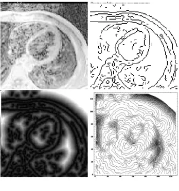Figure 5: MRI heart image: Top: Original image on the left, edge image on the right; Middle: distance map on the left, minimal action U with its level sets