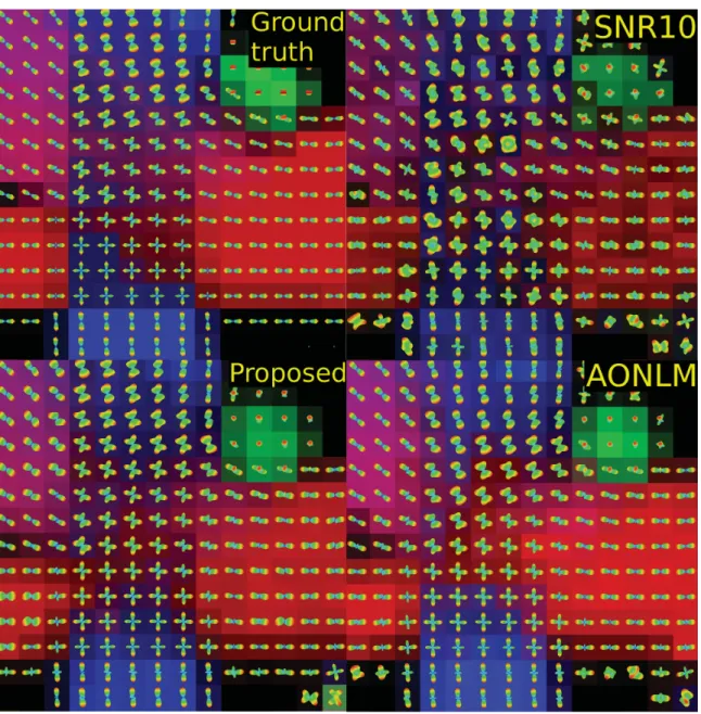 Figure A.1: ISBI Challenge CSA-ODFs reconstructed from the ISBI HARDI 2013 dataset, overlaid on the CFA map