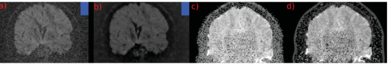 Figure 3.2: Histogram of the noise distribution in the background of a) before stabi- stabi-lization and b) after stabistabi-lization