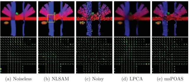 Figure 3.5: Top row : Colored FA map for the SNR 15 with N = 12 coils for the synthetic dataset