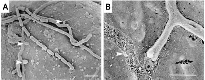 Figure 1.11. Colonization and penetration of potato by S. scabies.  