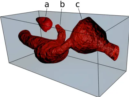 Figure 1.1 – Différents types de pores : a-pore isolé, b-bras mort, c-pore percolant