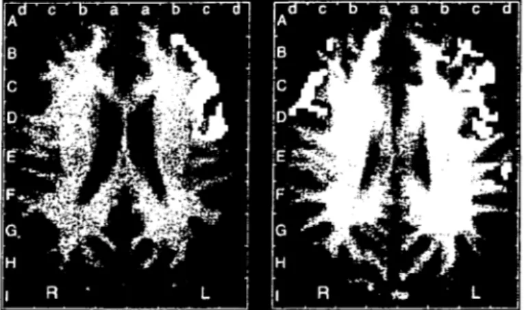 Figure 1 : à gauche, une image de cerveaux d' hommes .. à droite, une image de cerveaux de femmes