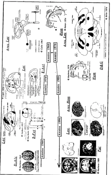 Figure 1 : Les images de la première approche du ronclionnement du' cerveau humain