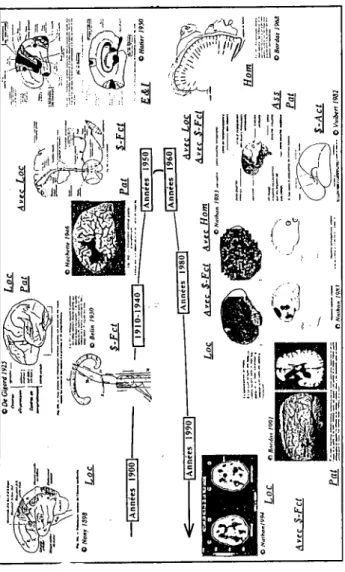 Figure 2 : Les imnges de ln deuxième npproche du fonctionnement du cervenu humain