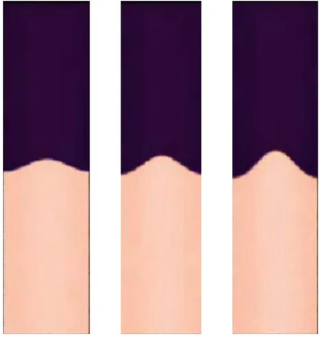 Fig 2b. Etape 1 de l’IRT. 
