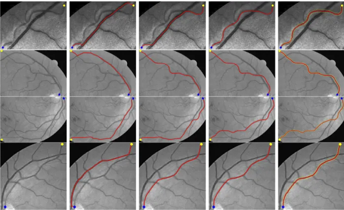 Fig. 9. Comparative results on retinal images. Column 1 Prescribed points which are indicated by dots