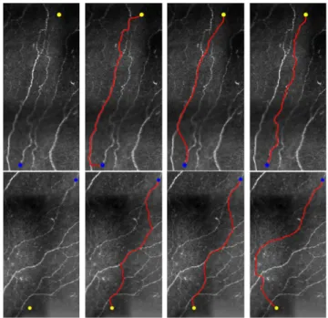 Fig. 11. Comparative results on neural fibre images. Column 1 Prescribed source and end points indicated by blue and yellow dots