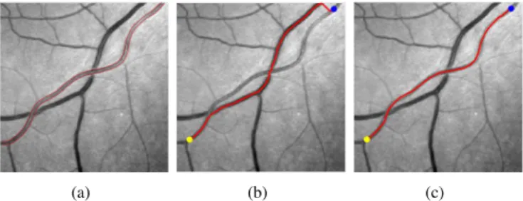 Fig. 1. Short branches combination problem. (a) A retinal image with red curves indicating the true boundaries of the target