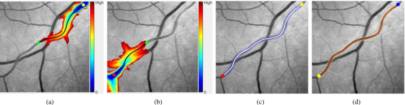 Fig. 7. (a) The geodesic distance map U s superimposed on the retinal patch. The black line indicates the geodesic curve C m,s and the red dot is the point s.