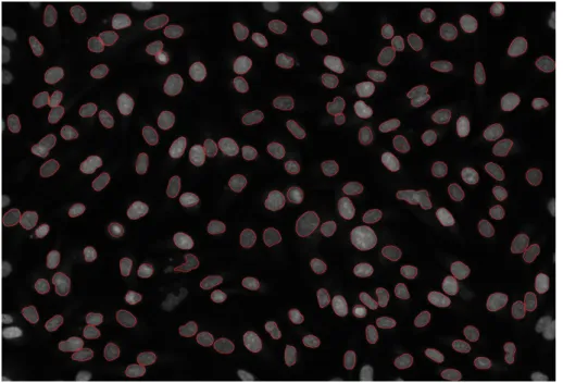 Figure 3.2: Nuclei segmentation on the DAPI channel, with segmentation contours indicated by red bands.