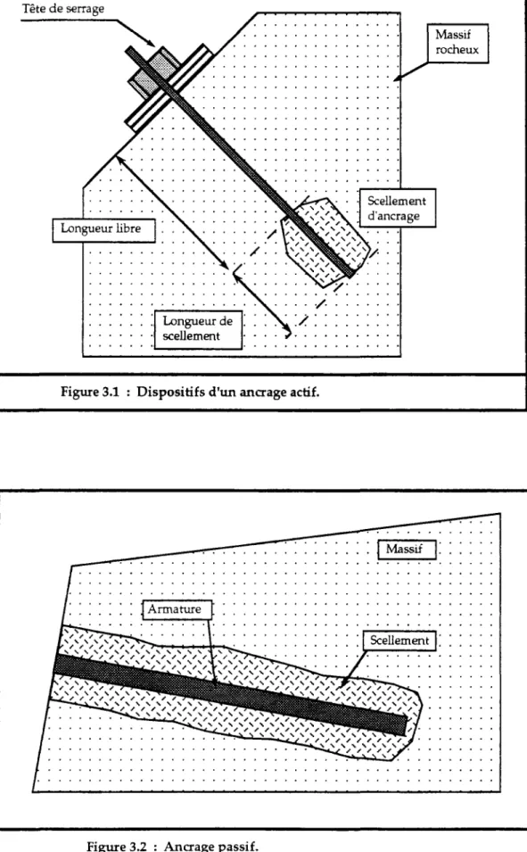 Figure 3.1 : Dispositifs d'un ancrage actif. 