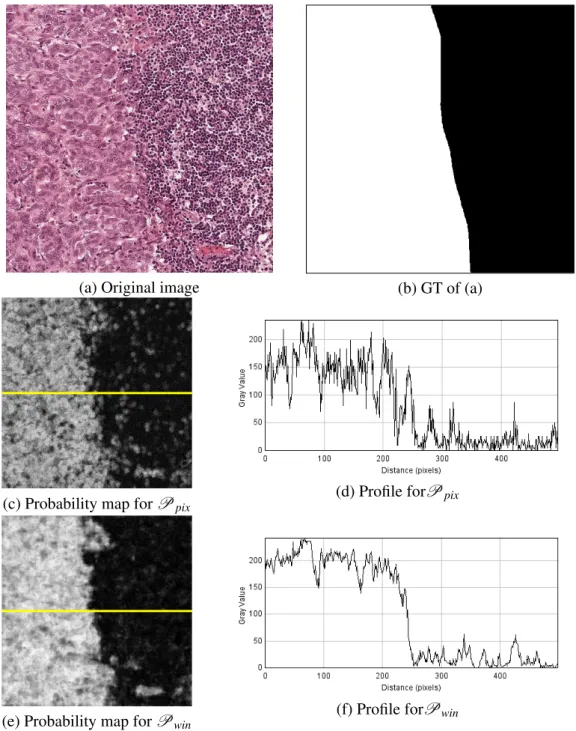 Figure 3.7: Classification results for an image of D 2 . Grey level profiles are evaluated along the