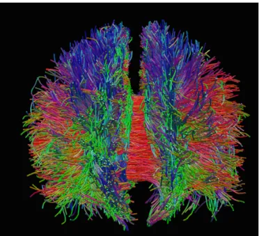 Figure 1.4 – Example of tractography of the white matter using DTI data. Image source: Alessandro Daducci, LTS5 diffusion group, Ecole Polytechnique federale de Lausanne.