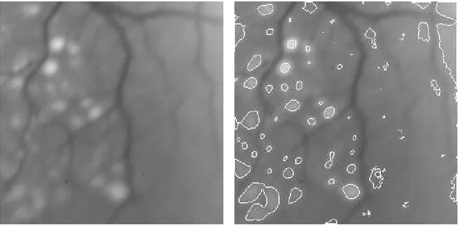 Figure 7: On the left the original image, on the right the set (Max h; ).