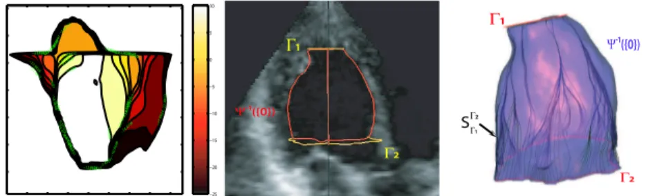 Figure 7: Left ventricle segmentation : on the left, some level sets of our solution Ψ on a plane