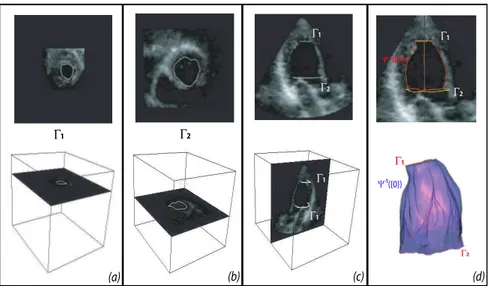 Figure 1: 3D ultrasound volume of a left ventricle: (a) and (b) show the two parallel slices where the user given curves Γ 1 and Γ 2 are drawn