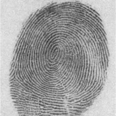 Fig. 5 . Noise removed using SureShrink.