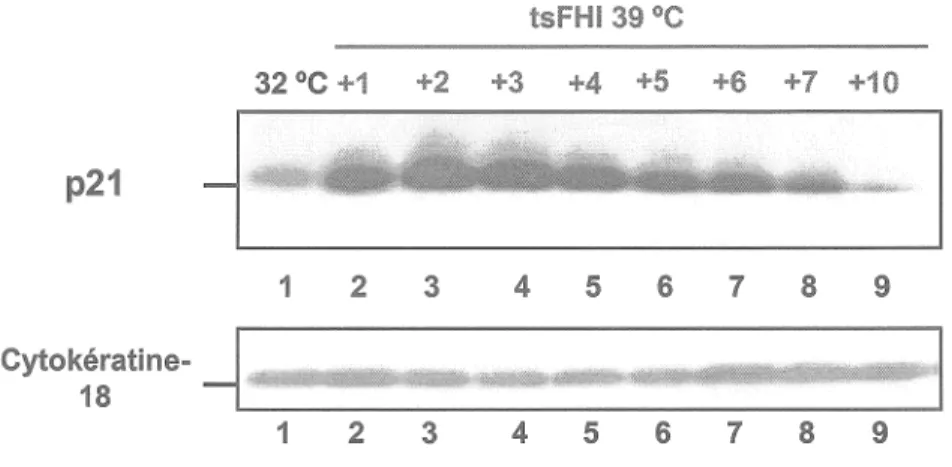 Figure 5.  Analyse de l'expression de la p21/WAF/Cip chez les cellules tsFHI  cultivées  à  32 et 39 °C