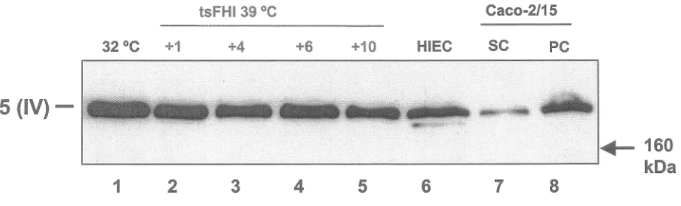 Figure 6.  Analyse de l'expression des protéines de la chaîne a5 du collagène  de type IV par les cellules tsFHI