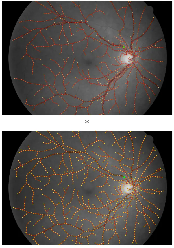 Figure 3.6: Comparison of the classical KPSM and the proposed algorithm in real retinal image