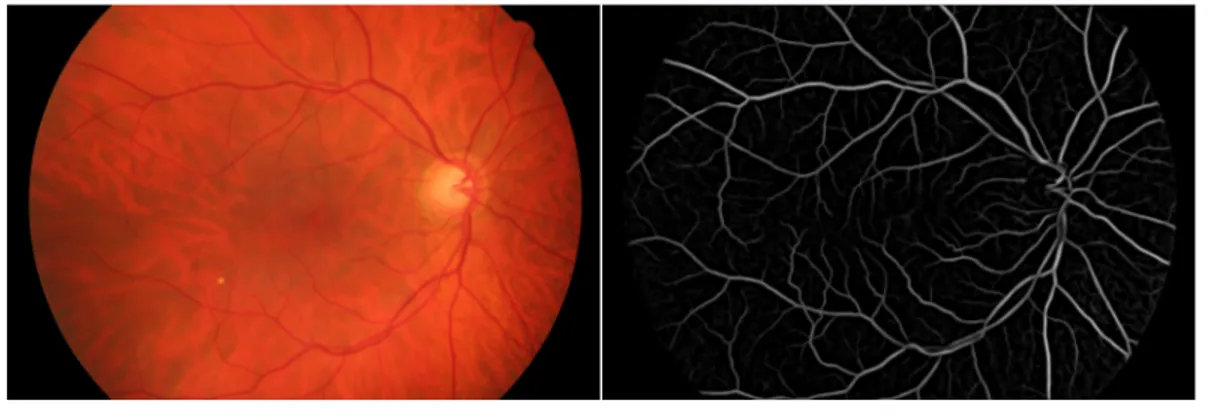 Figure 3.2: An example of retinal vessel image and its vesselness map.