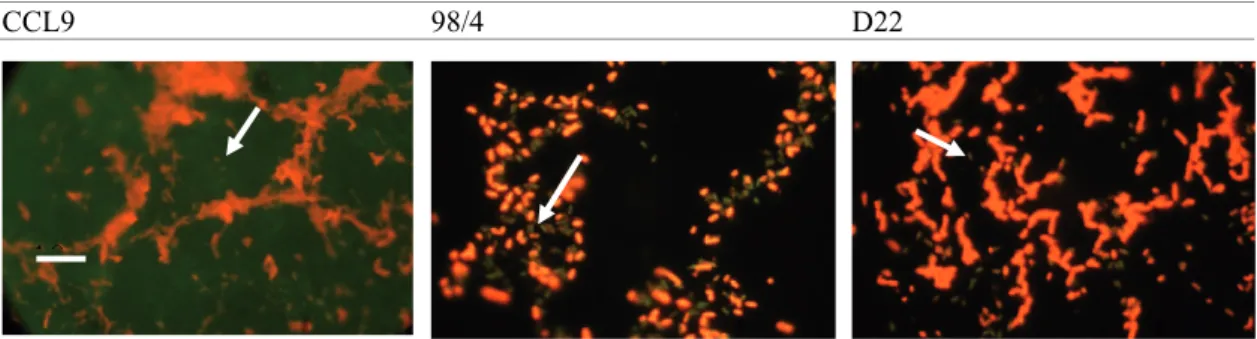 Figure VII 1. Observation du biofilm de  Bacillus  à 48h par microscopie à épifluorescence  sur des coupons en acier inoxydable (x 100) 