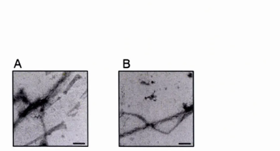 Figure  2.10  Immunogold  labeling  of  1 10  amyloid  assemblies  observed  by 